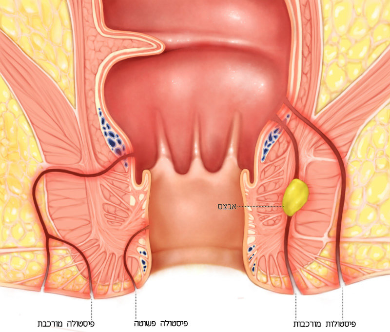 איור: יותם גלעדי